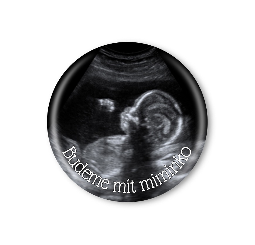 Magnetická placka - Budeme mít miminko